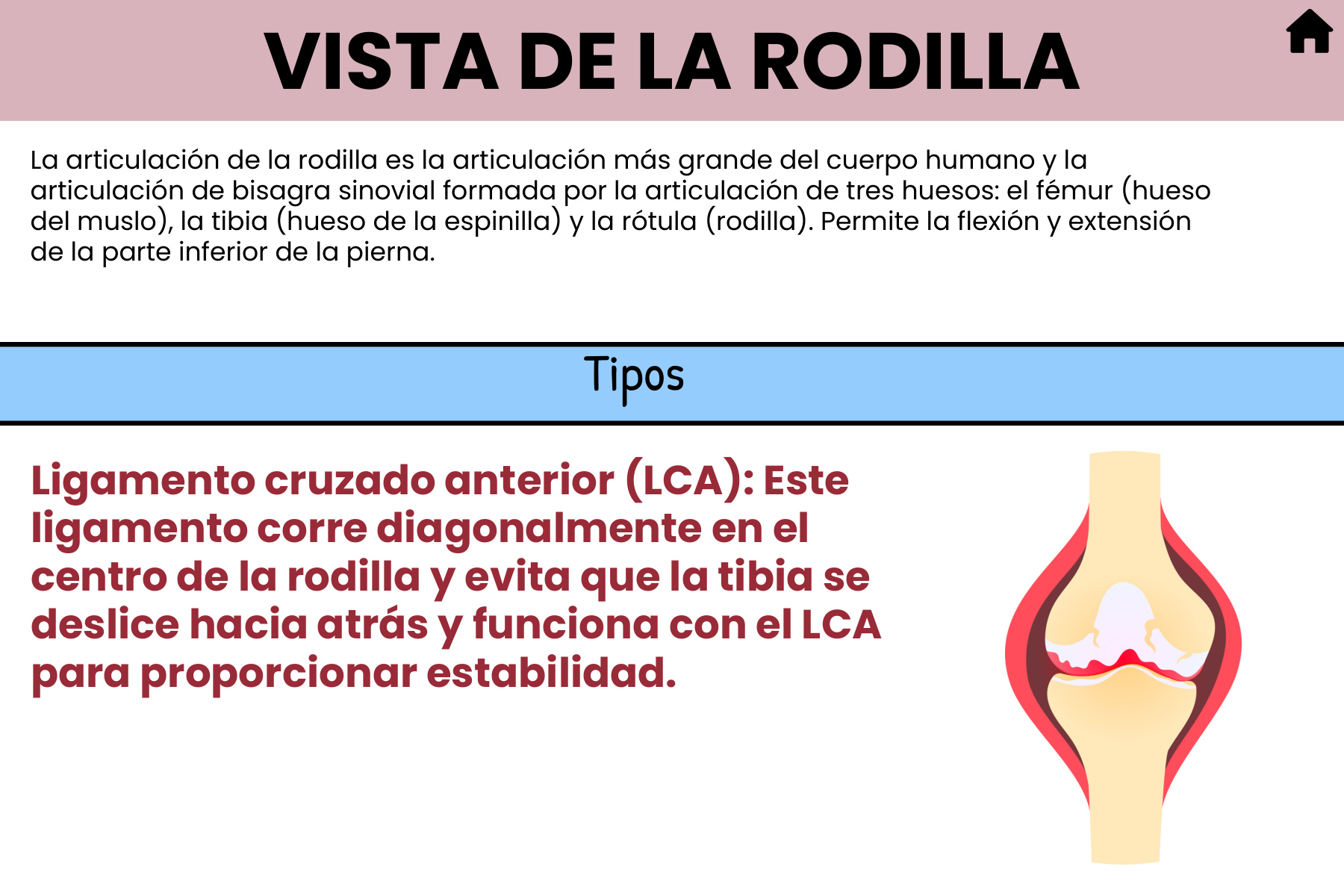 Flashcard: vista de la rodilla y sus tipos